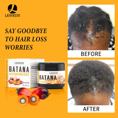 Fast Hair Growth Oil Africa Crazy Traction Alopecia Batana Hair Mask anti Hair Break Hair Strengthener Hair Loss Treatment Spray