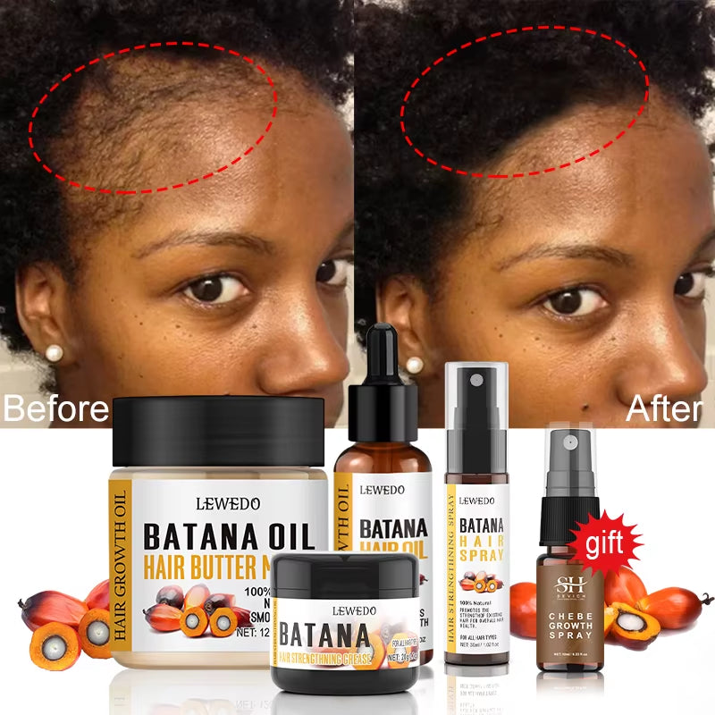 Fast Hair Growth Oil Africa Crazy Traction Alopecia Batana Hair Mask anti Hair Break Hair Strengthener Hair Loss Treatment Spray